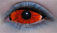 sclera lenses